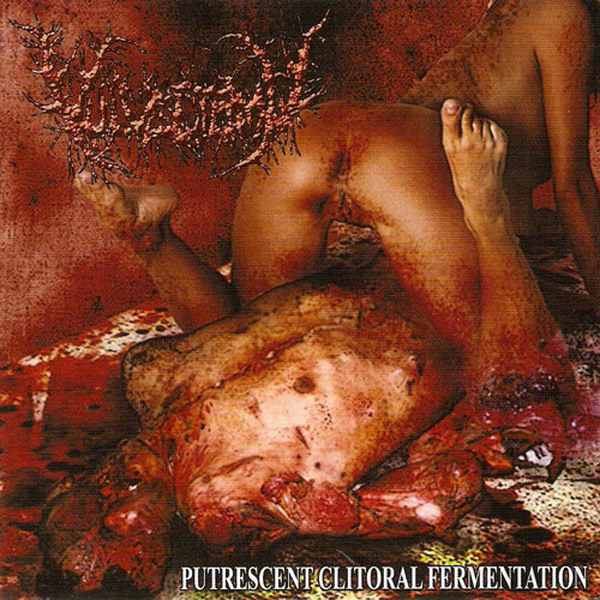 Vulvectomy - Putrescent Clitoral Fermentation (2007)