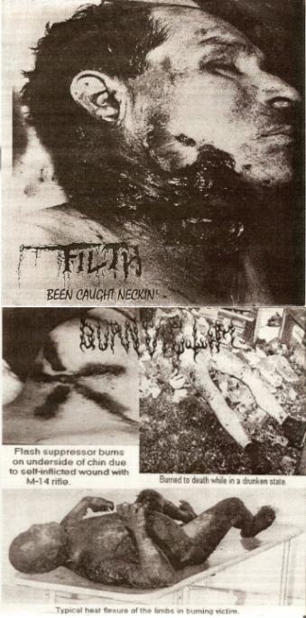 Burn Victim Baptized In Gasoline Burn Victim Baptized In Gasoline