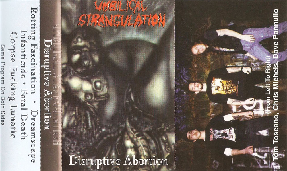 Umbilical Strangulation - Disruptive Abortion