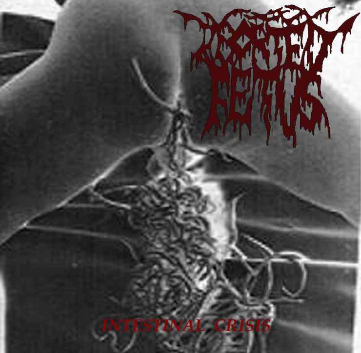 Aborted Fetus - Intestinal Crisis - Encyclopaedia Metallum: The Metal Archives