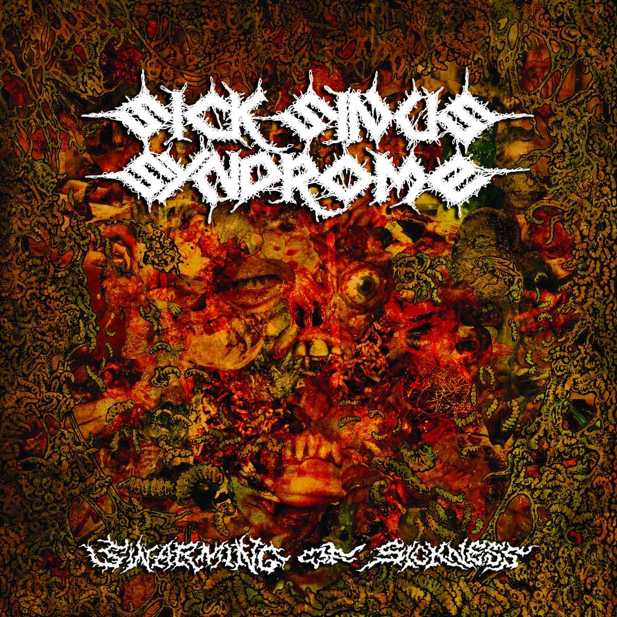 Sick Sinus Syndrome - Swarming of Sickness