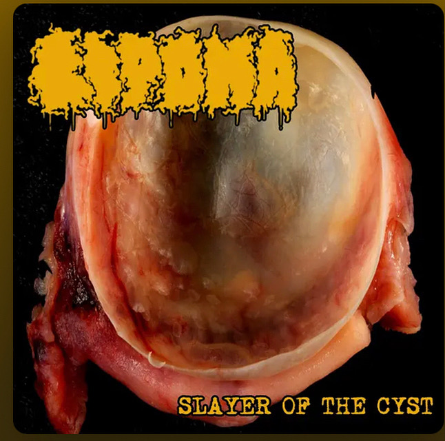 Обложка: Lipoma — Slayer of the Cyst