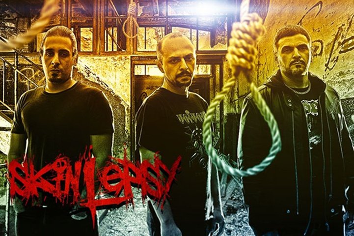 Skinlepsy - Photo
