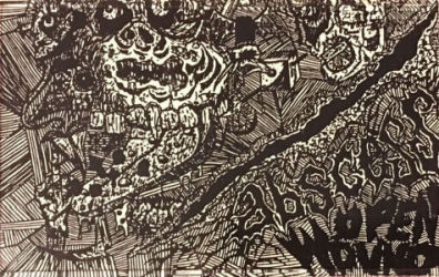 Abscess - Open Wound