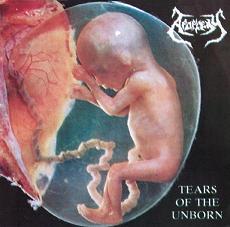 Apoplexy - Tears of the Unborn