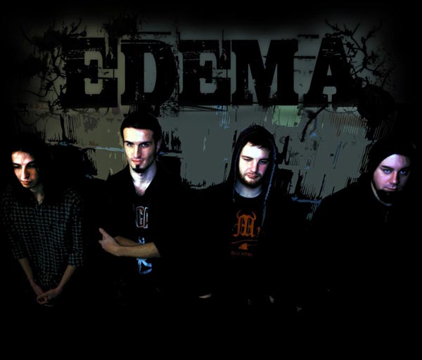Edema - Photo
