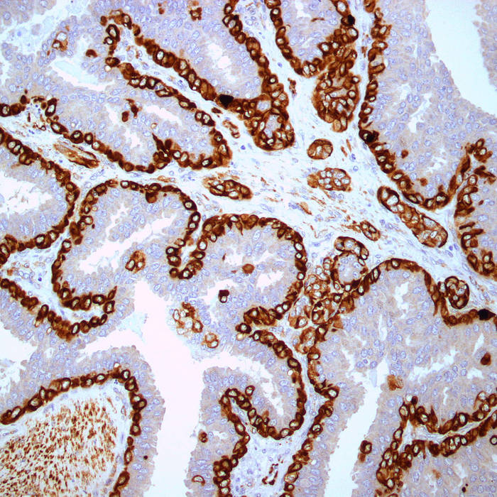 Immunohistochemistry - Of Which the Body Is Composed Demo 2017
